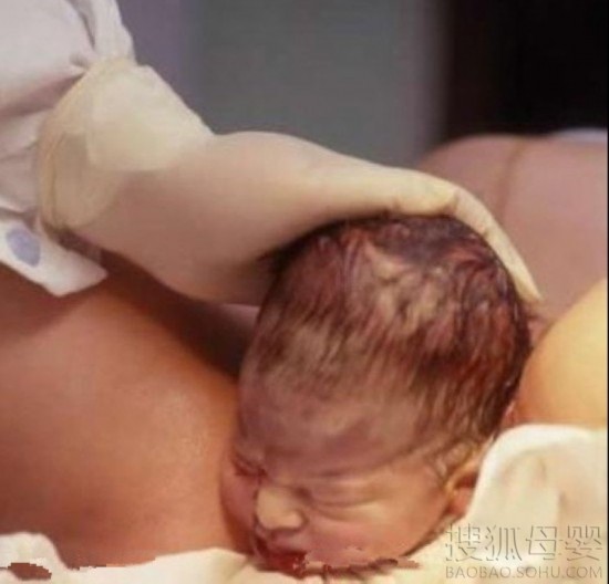 震撼组图!实拍孕妇顺产惊心全过程