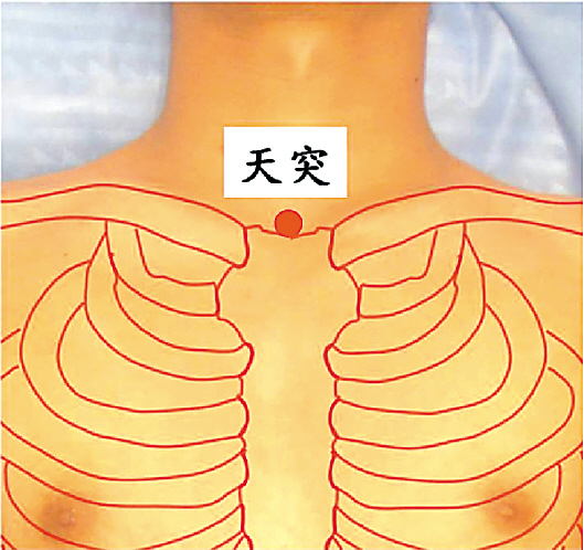 秋冬冷空气诱发哮喘 按一个穴位可止咳平喘