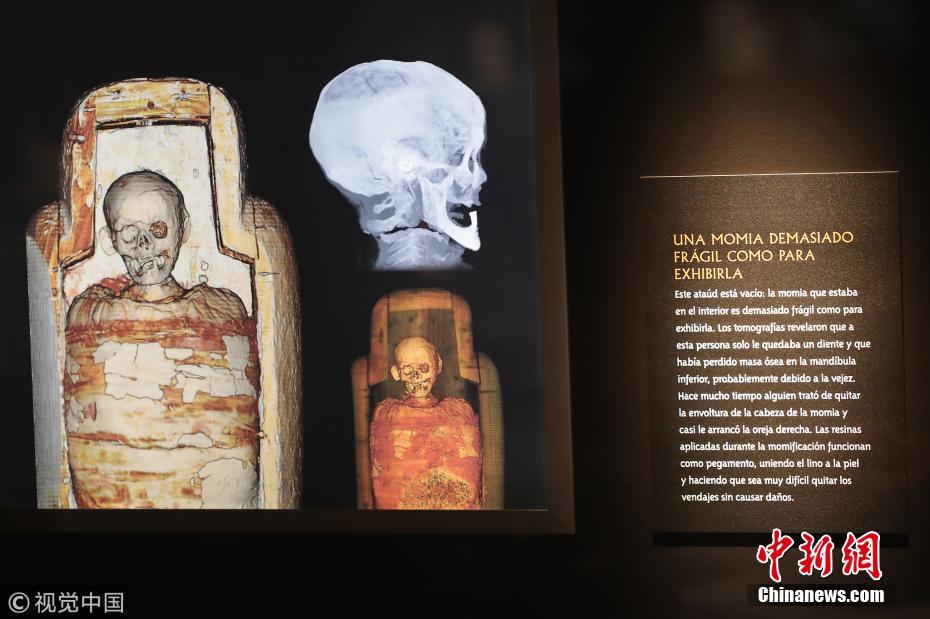 美国博物馆展出大批木乃伊文物 现场进行扫描