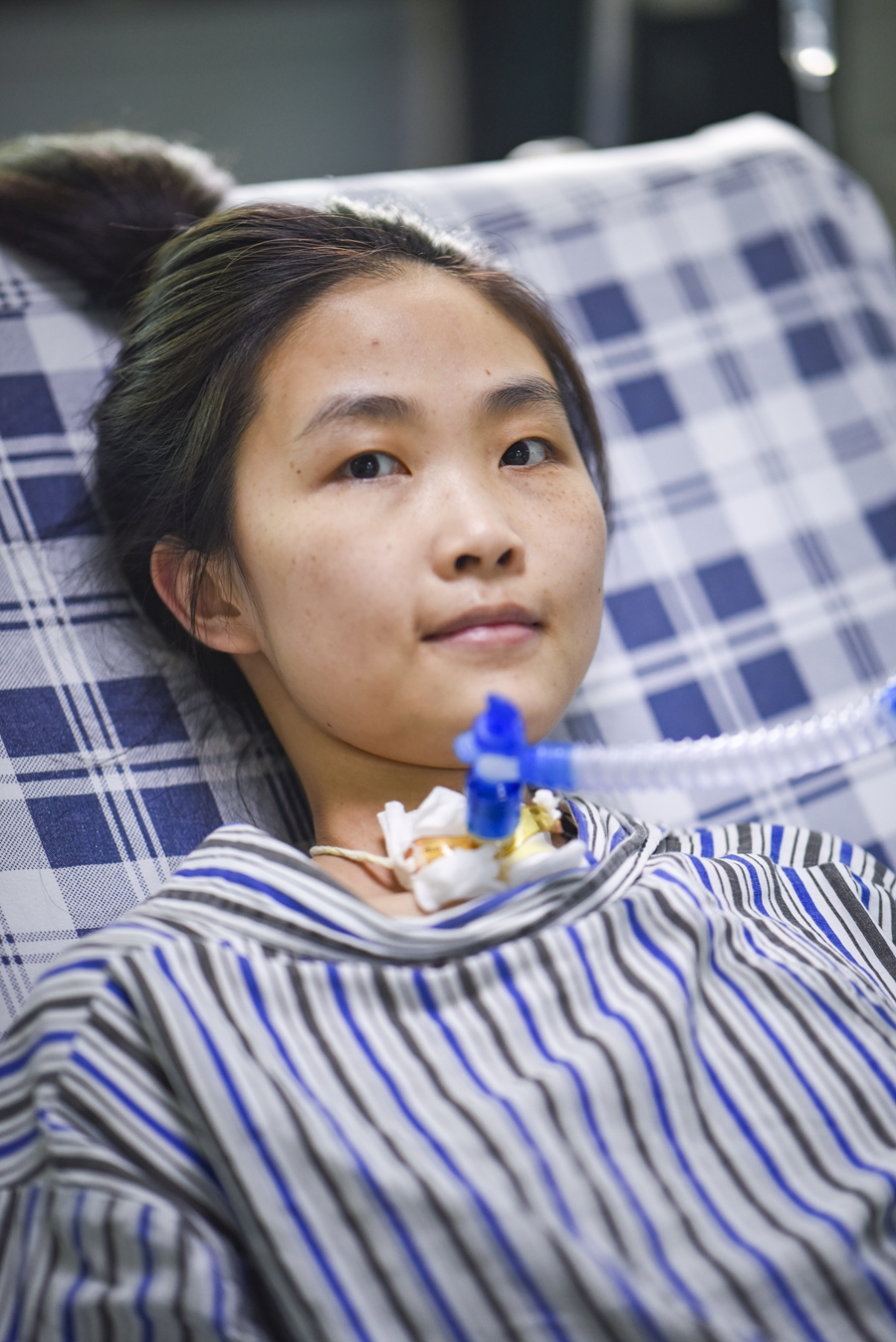 1989年出生的郑宇宁，是广东省第一例“庞贝氏症”患者。在清远市中医院的ICU病房，郑宇宁已经住了十年。由于呼吸衰竭，医生在郑宇宁的喉咙处切开，插入了一个吸管来连接呼吸机。目前郑宇宁必须依靠呼吸机维持生命。 金羊网记者 宋金峪 摄于 2018年5月26日

