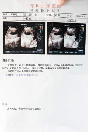 女工怀孕85天查出胎死30天 疑厂区污染所致(图)