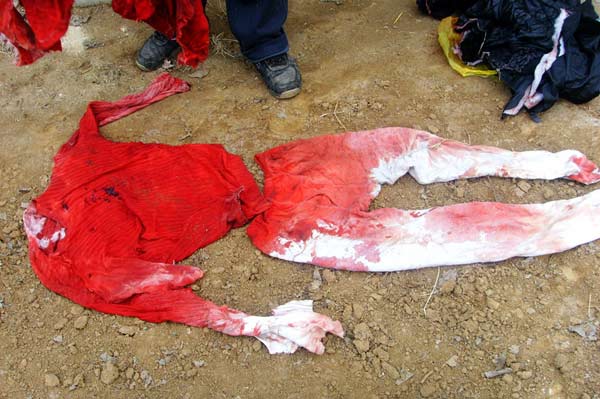家人提供的遗体照片显示,李冬冬右胸,右腹,右背,均有一处刀伤.