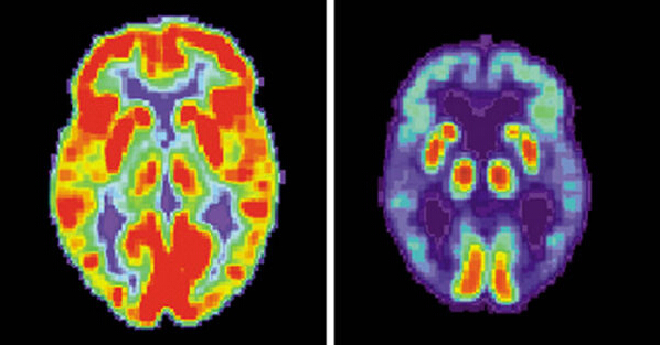 日本教授 疯狂 制造超级病毒 能够绕过人类免疫