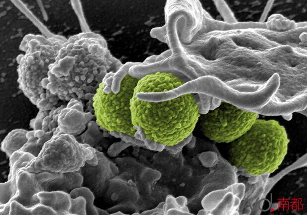  广州 地铁 检出超级细菌 ,感染或致命!如何预防_