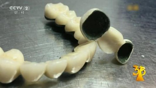 无证 废钢料制造假牙  专家称会产生有害元素_金