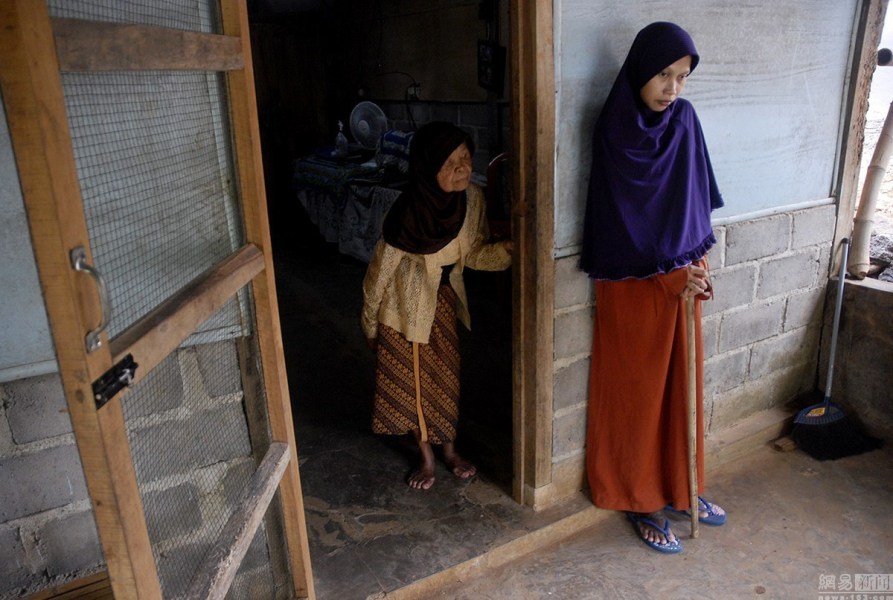 印尼女子患强直性脊柱炎25年成'木头人'