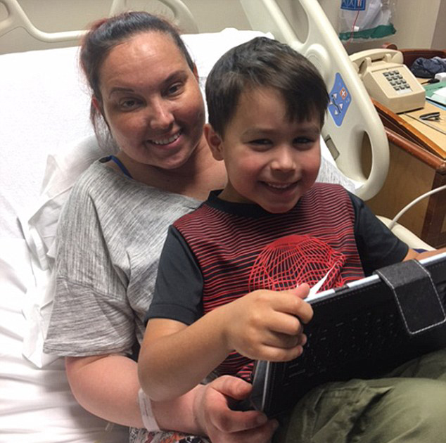 比基尼模特患肿瘤 一年发胖38斤