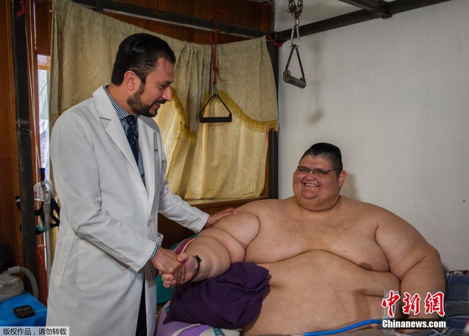 墨西哥男子体重曾达半吨 4个月治疗减去170公斤