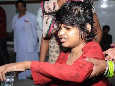 印度8岁“猴孩”与猴同住 靠四肢行走不会说话