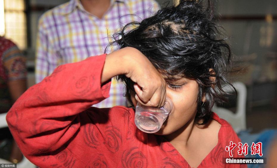 印度8岁“猴孩”与猴同住 靠四肢行走不会说话