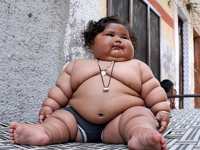 印度婴儿体重34斤 成“米其林小胖人”