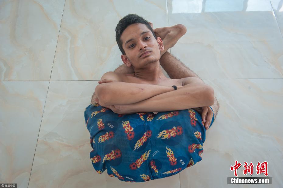 印度男孩柔韌性逆天 頭可旋轉180度