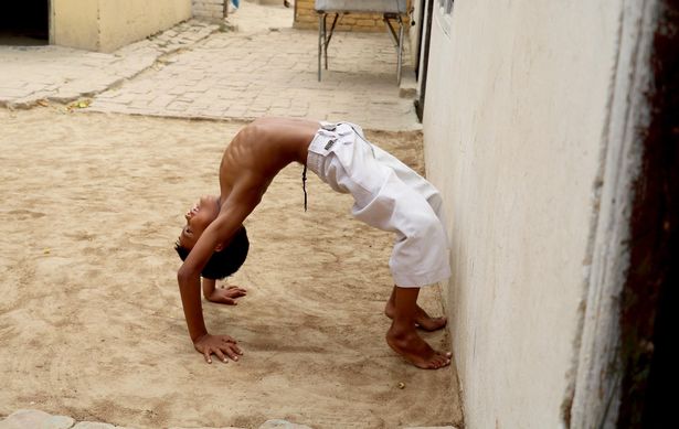 印度男童长“尾巴” 被当猴神受朝拜