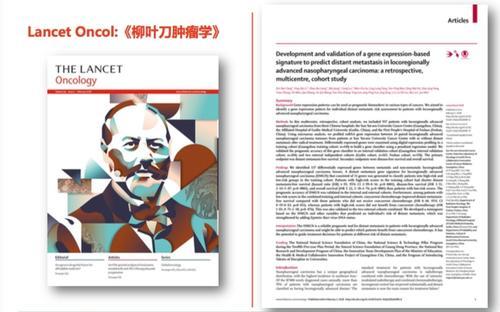 发表于国际顶级肿瘤学专业期刊《thelancetoncology》(柳叶刀肿瘤学