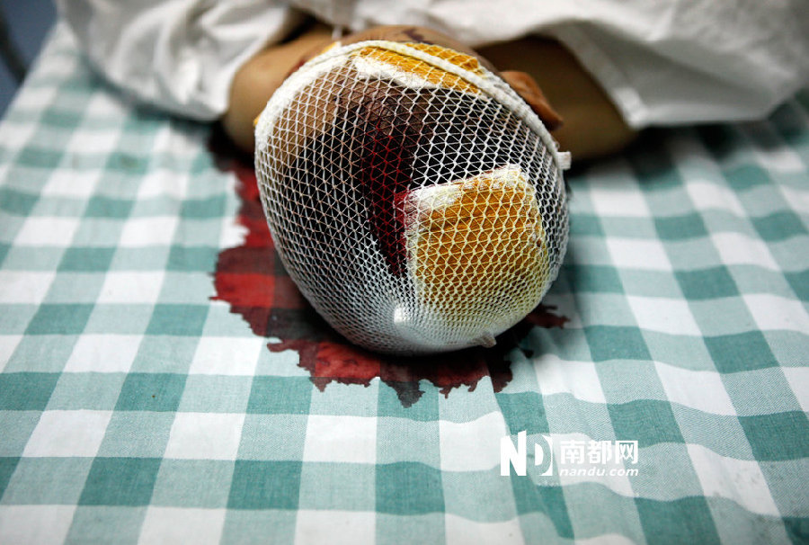 惠州:表叔公持铁锤狂砸姐弟一死一重伤