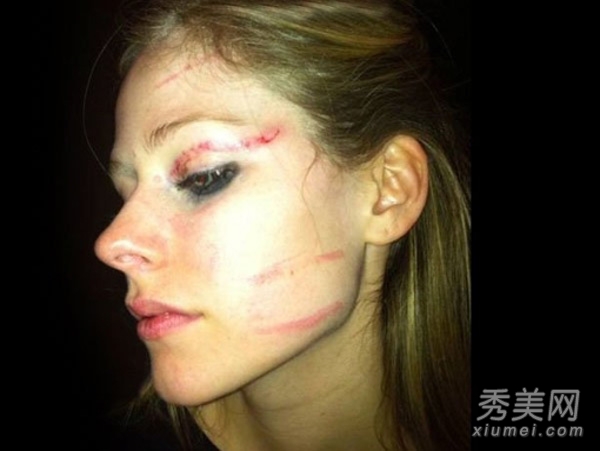 范玮琪摔伤缝25针 盘点明星面部受伤照